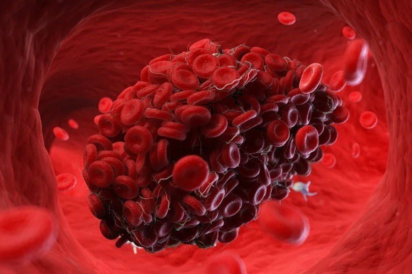 Clotted period blood is it normal during menstrual cycle? – Asan UK